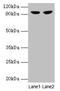 Glycogen Phosphorylase L antibody, LS-B12977, Lifespan Biosciences, Western Blot image 