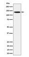 Tripartite Motif Containing 24 antibody, M03258-1, Boster Biological Technology, Western Blot image 