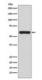 TNF Receptor Associated Factor 6 antibody, M00185, Boster Biological Technology, Western Blot image 