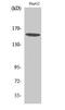 Phospholipase C Gamma 1 antibody, STJ95157, St John