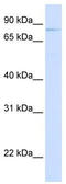 Olfactomedin Like 2B antibody, TA341977, Origene, Western Blot image 