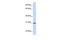 Stanniocalcin 1 antibody, GTX47080, GeneTex, Western Blot image 