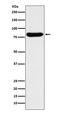 Glucuronidase Beta antibody, M02234, Boster Biological Technology, Western Blot image 