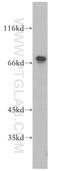 Sterol Regulatory Element Binding Transcription Factor 2 antibody, 14508-1-AP, Proteintech Group, Western Blot image 
