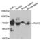 Interleukin 1 Receptor Associated Kinase 3 antibody, abx004187, Abbexa, Western Blot image 