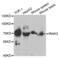 Interleukin-1 receptor-associated kinase 3 antibody, abx004187, Abbexa, Western Blot image 