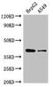 S-adenosylmethionine decarboxylase proenzyme antibody, orb47843, Biorbyt, Western Blot image 