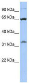 SLC8B1 antibody, TA333660, Origene, Western Blot image 