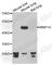 Matrix metalloproteinase-19 antibody, A6657, ABclonal Technology, Western Blot image 