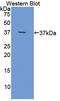 Olfactomedin 4 antibody, LS-C299033, Lifespan Biosciences, Western Blot image 