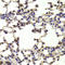 Homeobox B1 antibody, STJ28702, St John
