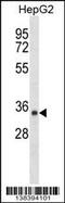 Short Chain Dehydrogenase/Reductase Family 39U Member 1 antibody, 59-786, ProSci, Western Blot image 