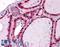 Interleukin 1 Receptor Associated Kinase 1 antibody, LS-B4361, Lifespan Biosciences, Immunohistochemistry paraffin image 