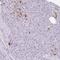 Lysophosphatidic Acid Receptor 4 antibody, NBP2-33757, Novus Biologicals, Immunohistochemistry paraffin image 
