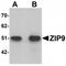 Solute Carrier Family 39 Member 9 antibody, TA319958, Origene, Western Blot image 