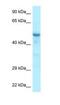 Coiled-Coil Domain Containing 6 antibody, NBP1-98370, Novus Biologicals, Western Blot image 