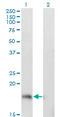 Prosolin antibody, LS-C197602, Lifespan Biosciences, Western Blot image 