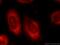 Protein Phosphatase 1 Catalytic Subunit Gamma antibody, 55150-1-AP, Proteintech Group, Immunofluorescence image 