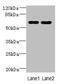 Zinc Finger Protein 215 antibody, CSB-PA026585LA01HU, Cusabio, Western Blot image 