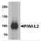 Piwi-like protein 2 antibody, MBS150536, MyBioSource, Western Blot image 