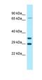 Sortilin 1 antibody, orb331290, Biorbyt, Western Blot image 