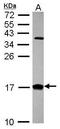 Cellular Retinoic Acid Binding Protein 2 antibody, GTX101551, GeneTex, Western Blot image 