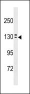 Ovochymase 1 antibody, 60-588, ProSci, Western Blot image 