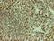 Interleukin 1 Receptor Associated Kinase 1 antibody, ab238, Abcam, Immunohistochemistry paraffin image 