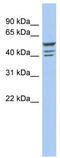 Zinc Finger Protein 140 antibody, TA343399, Origene, Western Blot image 