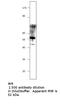 Potassium Voltage-Gated Channel Subfamily J Member 6 antibody, MBS540509, MyBioSource, Western Blot image 