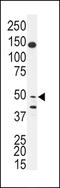 BPI fold containing family B, member 2 antibody, LS-C100626, Lifespan Biosciences, Western Blot image 