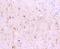 Glutamate Metabotropic Receptor 1 antibody, A03049-3, Boster Biological Technology, Immunohistochemistry paraffin image 