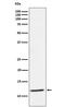 TYRO Protein Tyrosine Kinase Binding Protein antibody, M01996-1, Boster Biological Technology, Western Blot image 