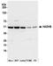 Hydroxyacyl-CoA Dehydrogenase Trifunctional Multienzyme Complex Subunit Beta antibody, A305-021A, Bethyl Labs, Western Blot image 