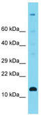 Transmembrane Protein 263 antibody, TA333490, Origene, Western Blot image 