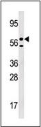 Uridine-Cytidine Kinase 1 Like 1 antibody, AP13862PU-N, Origene, Western Blot image 