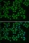 Bruton Tyrosine Kinase antibody, orb48294, Biorbyt, Immunofluorescence image 