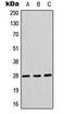 Aquaporin 1 (Colton Blood Group) antibody, LS-C353899, Lifespan Biosciences, Western Blot image 