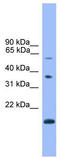 Notch Receptor 4 antibody, TA343476, Origene, Western Blot image 