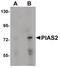 Protein Inhibitor Of Activated STAT 2 antibody, PA5-20952, Invitrogen Antibodies, Western Blot image 