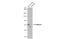 Sphingomyelin Phosphodiesterase 3 antibody, GTX135275, GeneTex, Western Blot image 