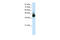 mRNA export factor antibody, 29-254, ProSci, Western Blot image 