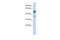 N-Myristoyltransferase 1 antibody, A03873, Boster Biological Technology, Western Blot image 