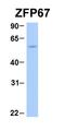 Zinc Finger And BTB Domain Containing 7B antibody, orb324428, Biorbyt, Western Blot image 