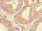 Checkpoint With Forkhead And Ring Finger Domains antibody, CSB-PA839315LA01HU, Cusabio, Immunohistochemistry paraffin image 