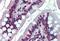 EWS RNA Binding Protein 1 antibody, MBS243010, MyBioSource, Immunohistochemistry paraffin image 