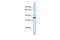 Regulator Of Microtubule Dynamics 3 antibody, PA5-43036, Invitrogen Antibodies, Western Blot image 