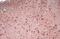 Forkhead Box P1 antibody, GTX133394, GeneTex, Immunohistochemistry paraffin image 