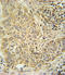 Aryl Hydrocarbon Receptor antibody, LS-C156174, Lifespan Biosciences, Immunohistochemistry paraffin image 