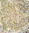 Aryl Hydrocarbon Receptor antibody, LS-C156174, Lifespan Biosciences, Immunohistochemistry paraffin image 